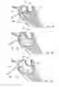 Fig. 33 - DEVICES, SYSTEMS AND METHODS FOR DIAGNOSING AND TREATING SINUSITIS AND OTHER DISORDERS OF THE EARS, NOSE AND/OR THROAT