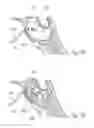 Fig. 34 - DEVICES, SYSTEMS AND METHODS FOR DIAGNOSING AND TREATING SINUSITIS AND OTHER DISORDERS OF THE EARS, NOSE AND/OR THROAT
