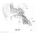Fig. 41 - DEVICES, SYSTEMS AND METHODS FOR DIAGNOSING AND TREATING SINUSITIS AND OTHER DISORDERS OF THE EARS, NOSE AND/OR THROAT