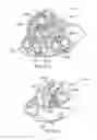Fig. 08 - Surgical system entry guide