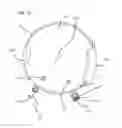 Fig. 13 - Surgical robotic access system