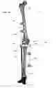 Fig. 20 - Clamping device for use with an anatomic external fixation device