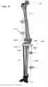 Fig. 24 - Clamping device for use with an anatomic external fixation device