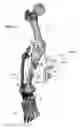 Fig. 29 - Clamping device for use with an anatomic external fixation device