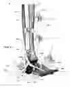 Fig. 32 - Clamping device for use with an anatomic external fixation device