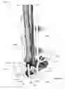 Fig. 33 - Clamping device for use with an anatomic external fixation device