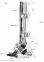 Fig. 34 - Clamping device for use with an anatomic external fixation device