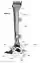 Fig. 41 - Clamping device for use with an anatomic external fixation device