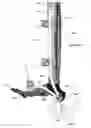 Fig. 42 - Clamping device for use with an anatomic external fixation device