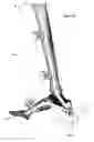Fig. 49 - Clamping device for use with an anatomic external fixation device