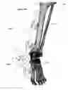 Fig. 50 - Clamping device for use with an anatomic external fixation device