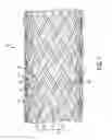 Fig. 14 - Woven retention devices, systems and methods