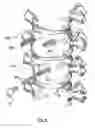 Fig. 05 - Bone Fixation Apparatus