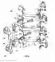 Fig. 06 - Bone Fixation Apparatus