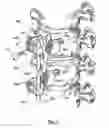 Fig. 07 - Bone Fixation Apparatus