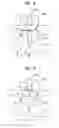Fig. 05 - Interspinous stabilization implant
