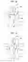 Fig. 06 - Interspinous stabilization implant