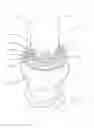 Fig. 01 - Surgical instrument and methods of use