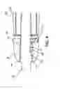 Fig. 04 - Instruments for use during spine surgery