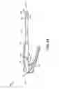 Fig. 06 - Instruments for use during spine surgery