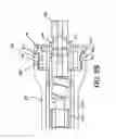 Fig. 11 - Instruments for use during spine surgery