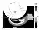 Fig. 01 - Methods and systems for treating urinary stress incontinence