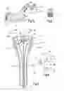 Fig. 03 - Ablation device for large-area mucosal ablation