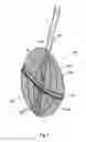 Fig. 02 - Devices, systems, and methods for valve removal