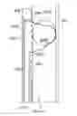 Fig. 11 - Apparatus and method for assessing tissue treatment