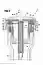 Fig. 05 - Surgical system for connecting body tissue