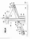 Fig. 20 - Surgical system for connecting body tissue