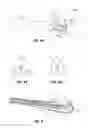 Fig. 04 - APPARATUS, SYSTEM AND METHOD FOR PERFORMING AN ELECTROSURGICAL PROCEDURE
