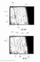 Fig. 06 - Methods and systems for directing movement of a tool in hair transplantation procedures