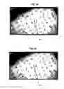Fig. 10 - Methods and systems for directing movement of a tool in hair transplantation procedures
