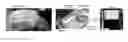 Fig. 01 - Imaging toolbox for guiding cardiac resynchronization therapy implantation from patient-specific imaging and body surface potential mapping data
