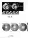Fig. 05 - Imaging toolbox for guiding cardiac resynchronization therapy implantation from patient-specific imaging and body surface potential mapping data