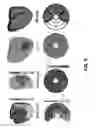 Fig. 10 - Imaging toolbox for guiding cardiac resynchronization therapy implantation from patient-specific imaging and body surface potential mapping data