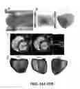 Fig. 12 - Imaging toolbox for guiding cardiac resynchronization therapy implantation from patient-specific imaging and body surface potential mapping data