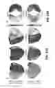 Fig. 14 - Imaging toolbox for guiding cardiac resynchronization therapy implantation from patient-specific imaging and body surface potential mapping data