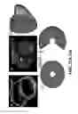 Fig. 16 - Imaging toolbox for guiding cardiac resynchronization therapy implantation from patient-specific imaging and body surface potential mapping data