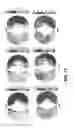 Fig. 18 - Imaging toolbox for guiding cardiac resynchronization therapy implantation from patient-specific imaging and body surface potential mapping data