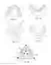 Fig. 02 - Edentulous surgical guide