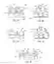 Fig. 04 - Edentulous surgical guide