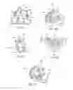 Fig. 05 - Edentulous surgical guide