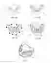 Fig. 06 - Edentulous surgical guide