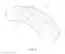 Fig. 04 - DENTAL SEPARATOR AND MATRIX SYSTEM FOR PRODUCING DENTAL RESTORATIONS