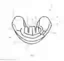 Fig. 04 - Oral appliance, system and method for correcting class III problems of mandibular prognathism