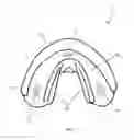 Fig. 06 - Oral appliance, system and method for correcting class III problems of mandibular prognathism