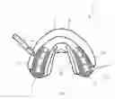 Fig. 07 - Oral appliance, system and method for correcting class III problems of mandibular prognathism