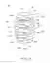 Fig. 03 - Dental implant for bone collection and distribution